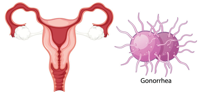 علت عفونت واژن چیست؟