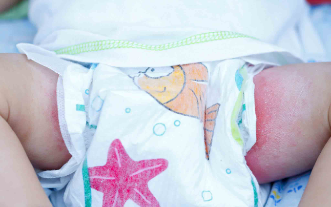 عوارض استفاده از پوشک نامناسب برای نوزاد