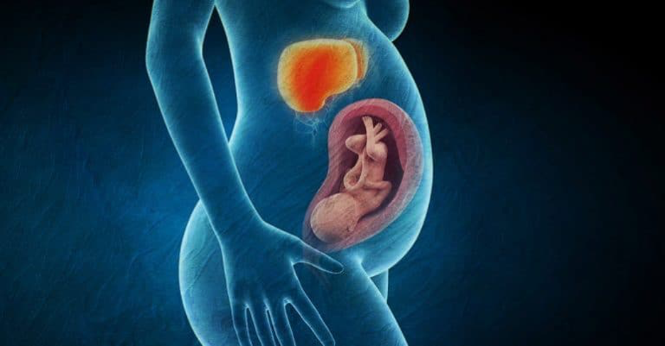 علل بیماری‌های کبدی در دوران بارداری