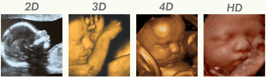 تفاوت تصاویر در سونوگرافی‌های مختلف