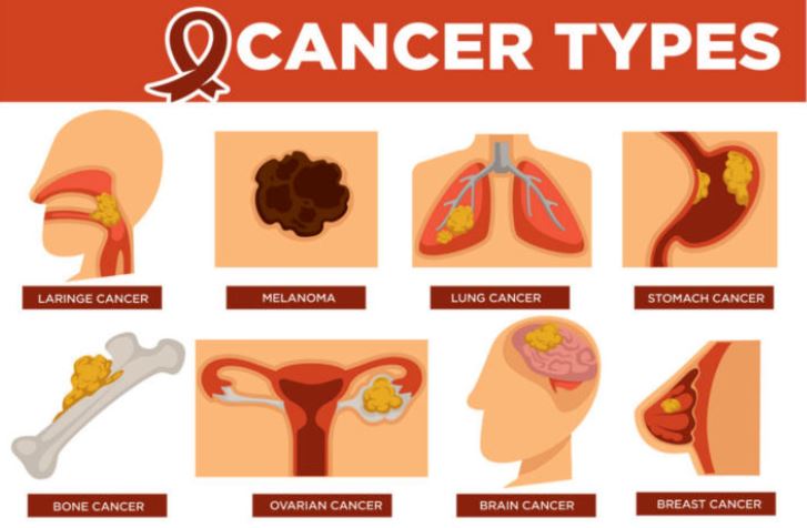 حقایق سرطان برای زنان