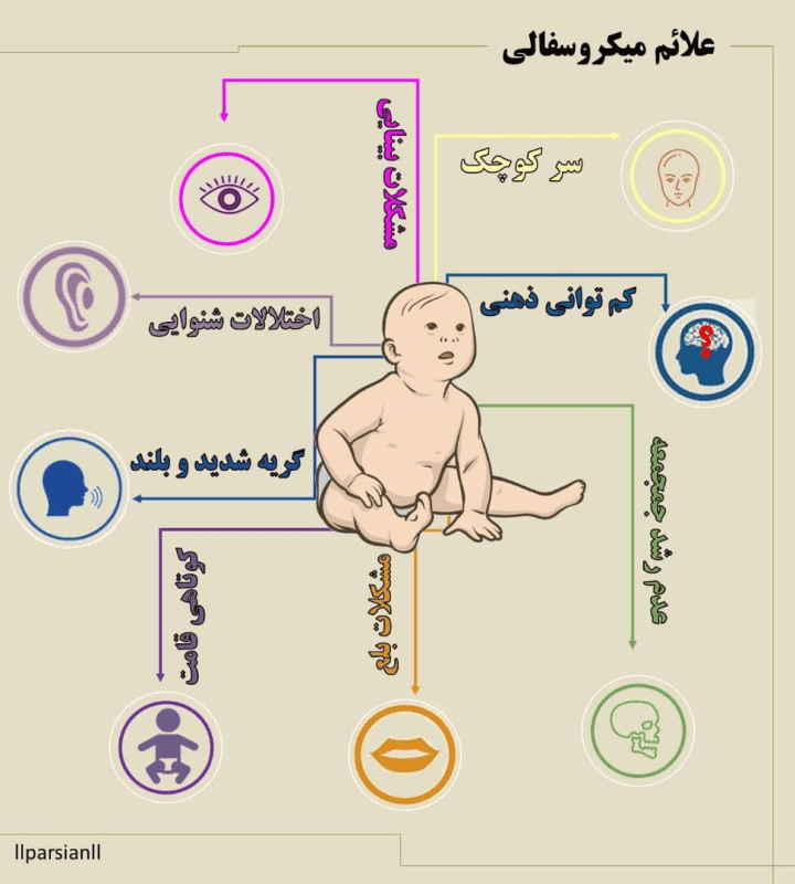 علائم میکروسفالی چیست؟