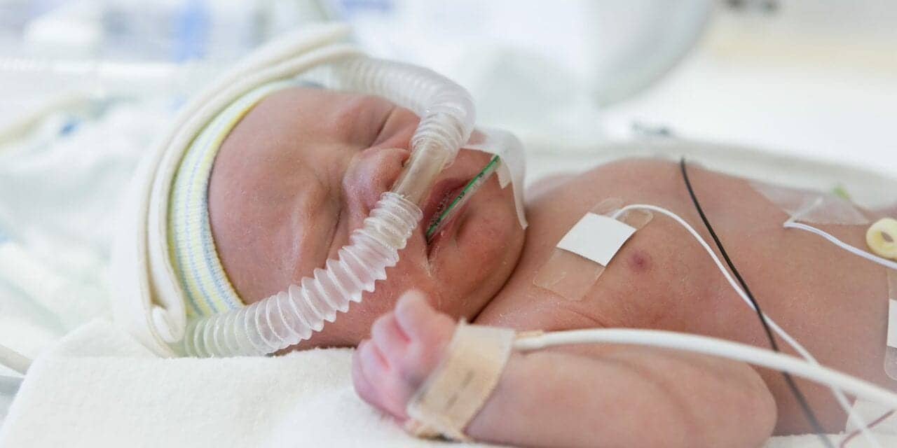 عارضه فشار خون ریوی مداوم نوزاد چقدر شایع است؟