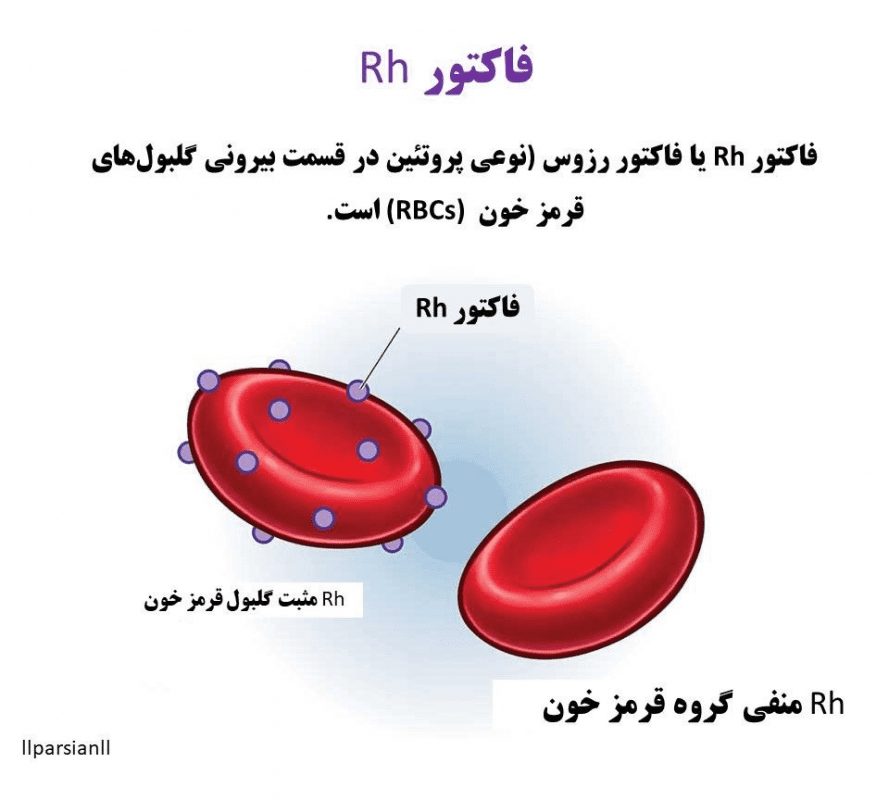 درمان ناسازگاری خونی Rh قبل از تولد