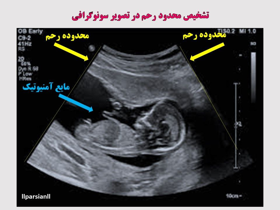 تفسیر و خواندن سونوگرافی بارداری