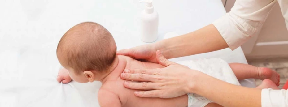 درمان اگزما در نوزاد