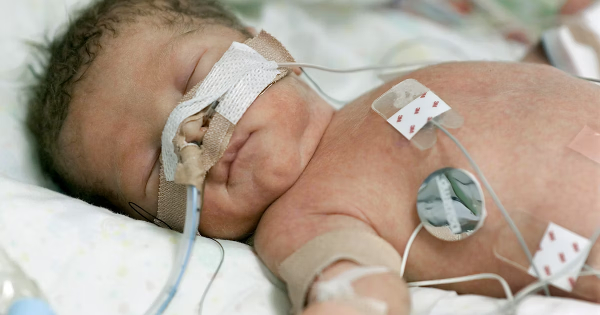 عوارض نقایص مادرزادی قلب در کودکان