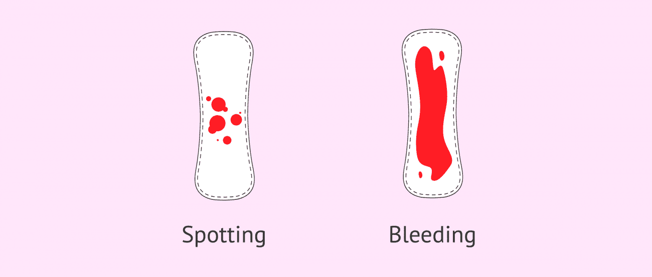 تفاوت بین خونریزی و لکه بینی چیست؟