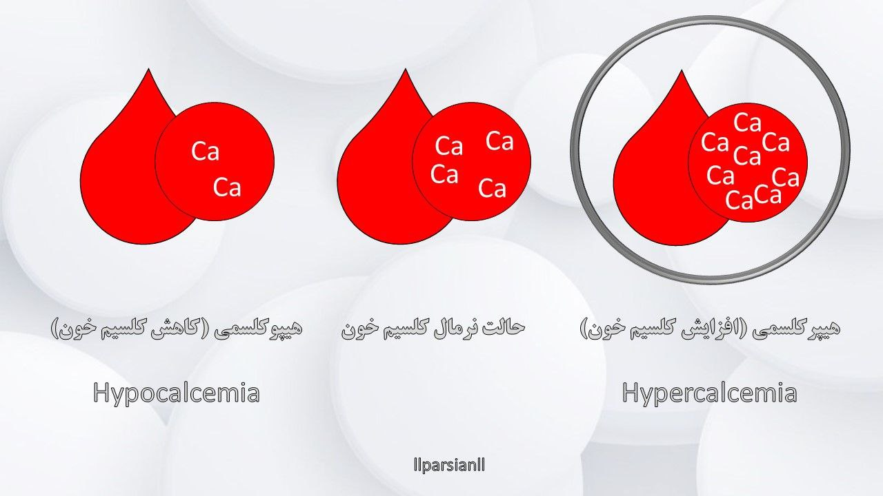 هیپرکلسمی (افزایش کلسیم خون) چیست و چگونه درمان می‌شود؟