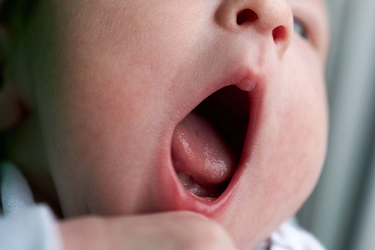 تمیز کردن زبان نوزاد